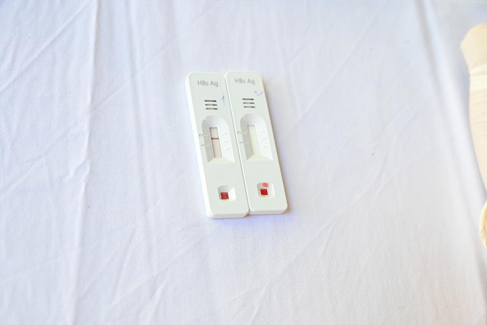 1 TIẾP NHẬN - KHÁM SÀN LỌC 1 TIẾP NHẬN - KHÁM SÀN LỌC